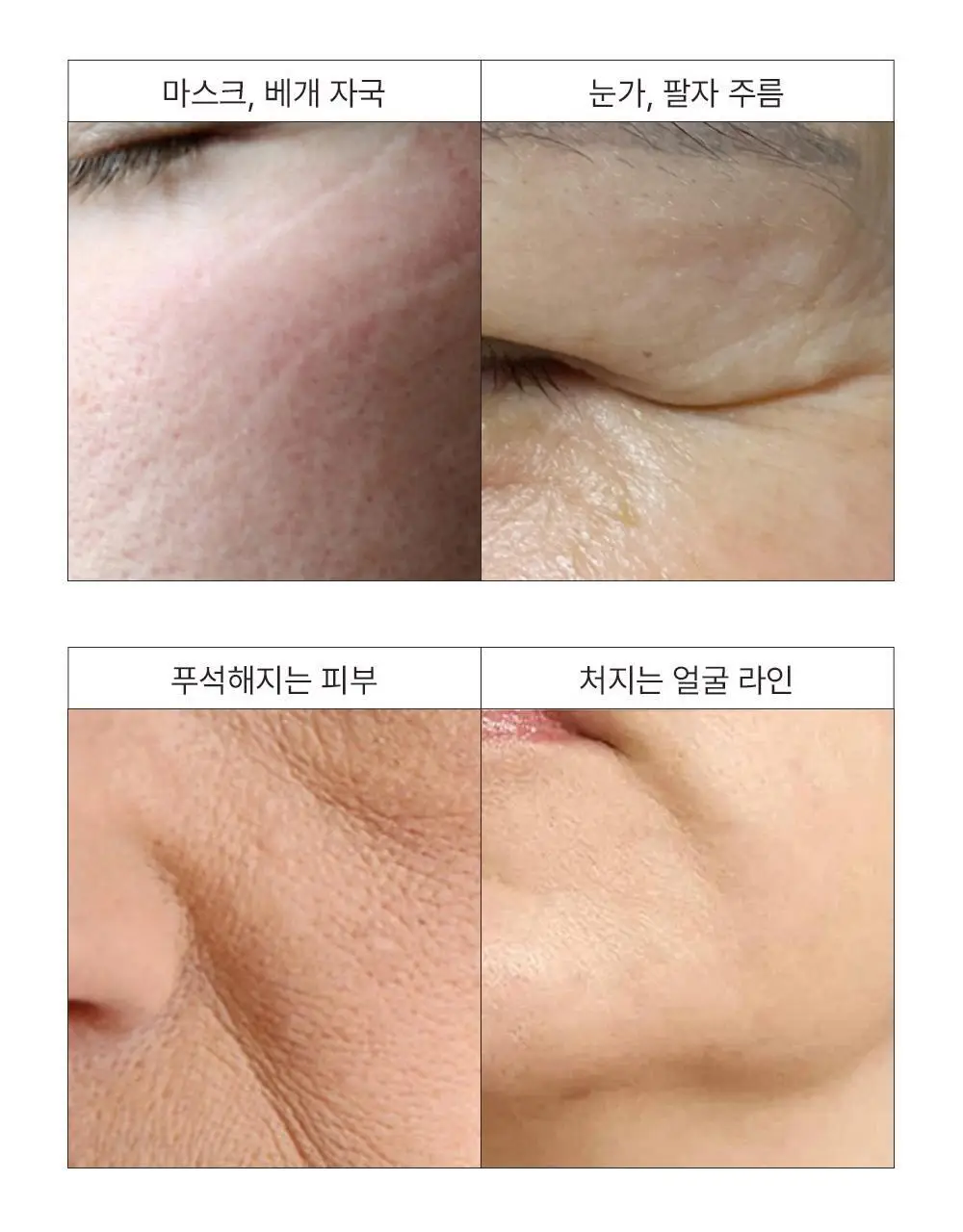 [주름리프팅] 퍼셀 82% 하이-도즈 펩타이드 콜라겐 앰플 20ml 상세페이지 12